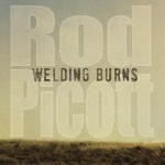 Buy Welding Burns