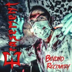 Buy Beyond Recovery