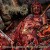 Purchase Uterovaginal Insertion Of Extirpated Anomalies Mp3